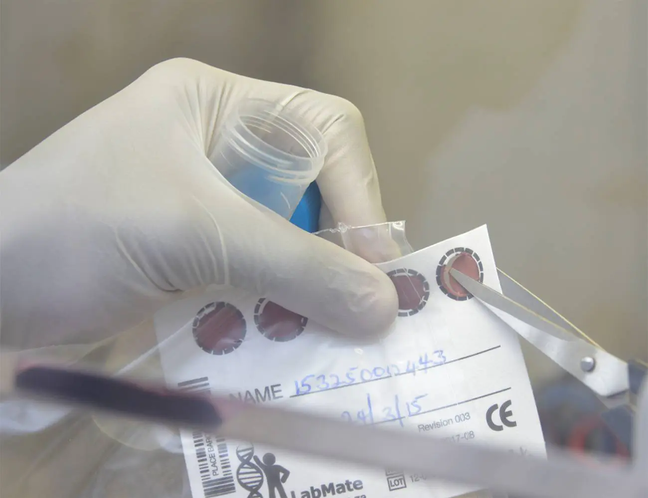 Breakthrough global agreement sharply lowers price of early infant diagnosis of HIV