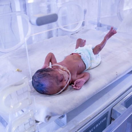 A neonate in an incubator sleeps while receiving supplemental oxygen.