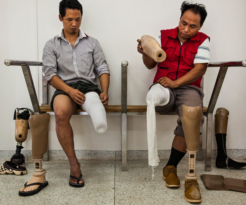 Two men on a bench are putting on prosthetic liners and socks with a prosthetic leg in front of each ready to be put on as well. Credit: UNICEF, Brown