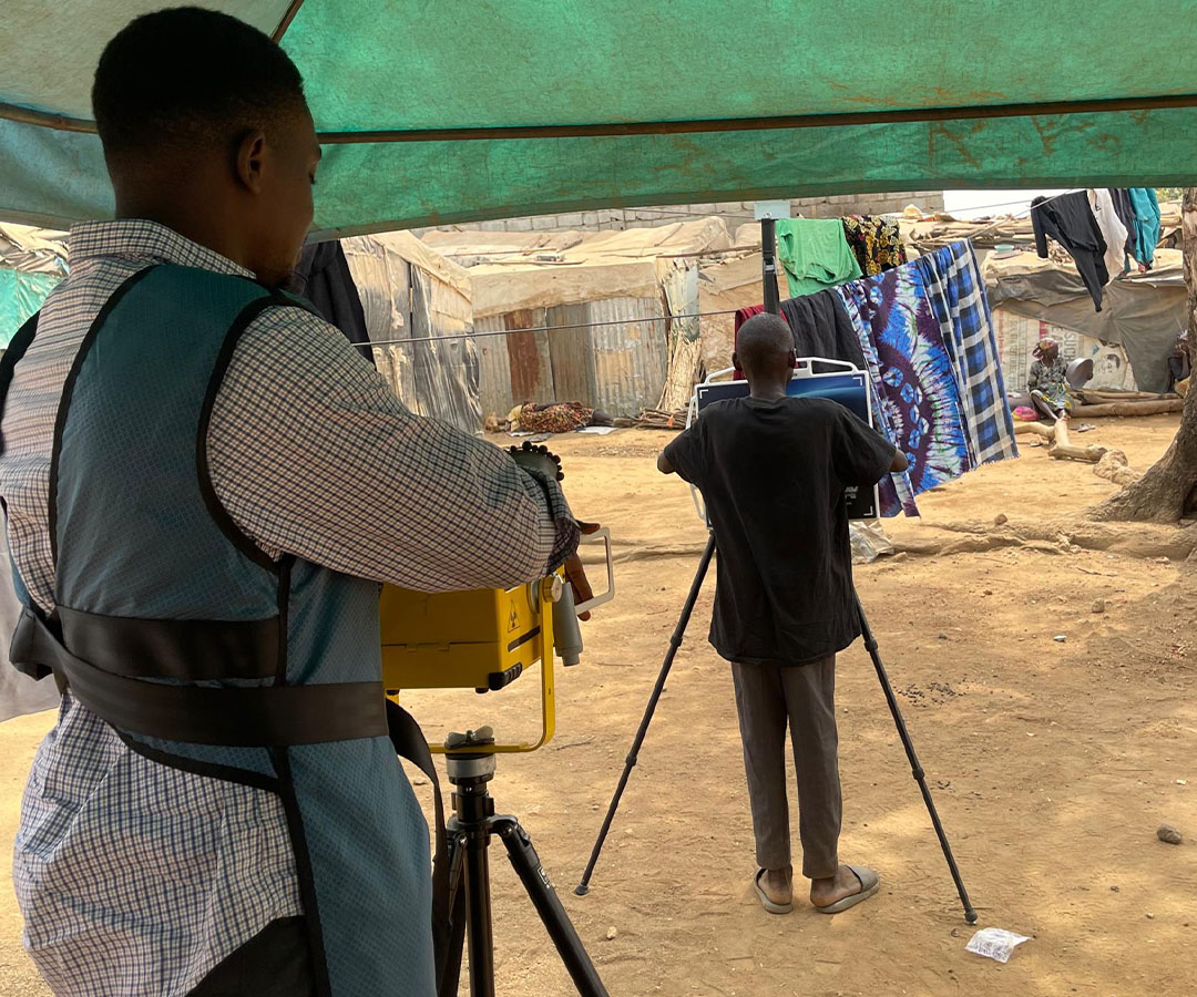 A healthcare worker uses an x-ray device to screen a patient for tuberculosis in a rural camp in Nigeria
